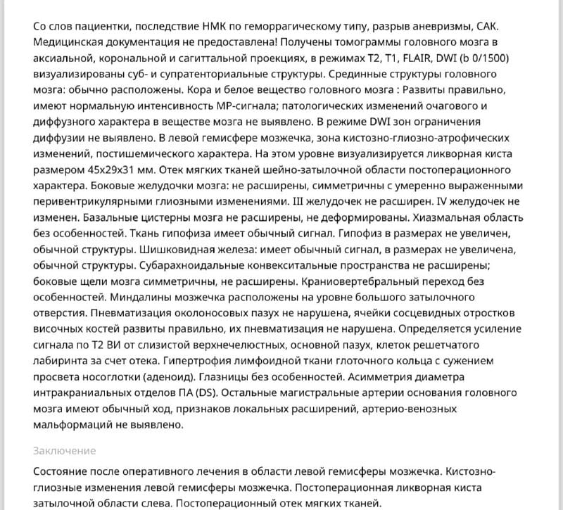 Вот моё МРТ